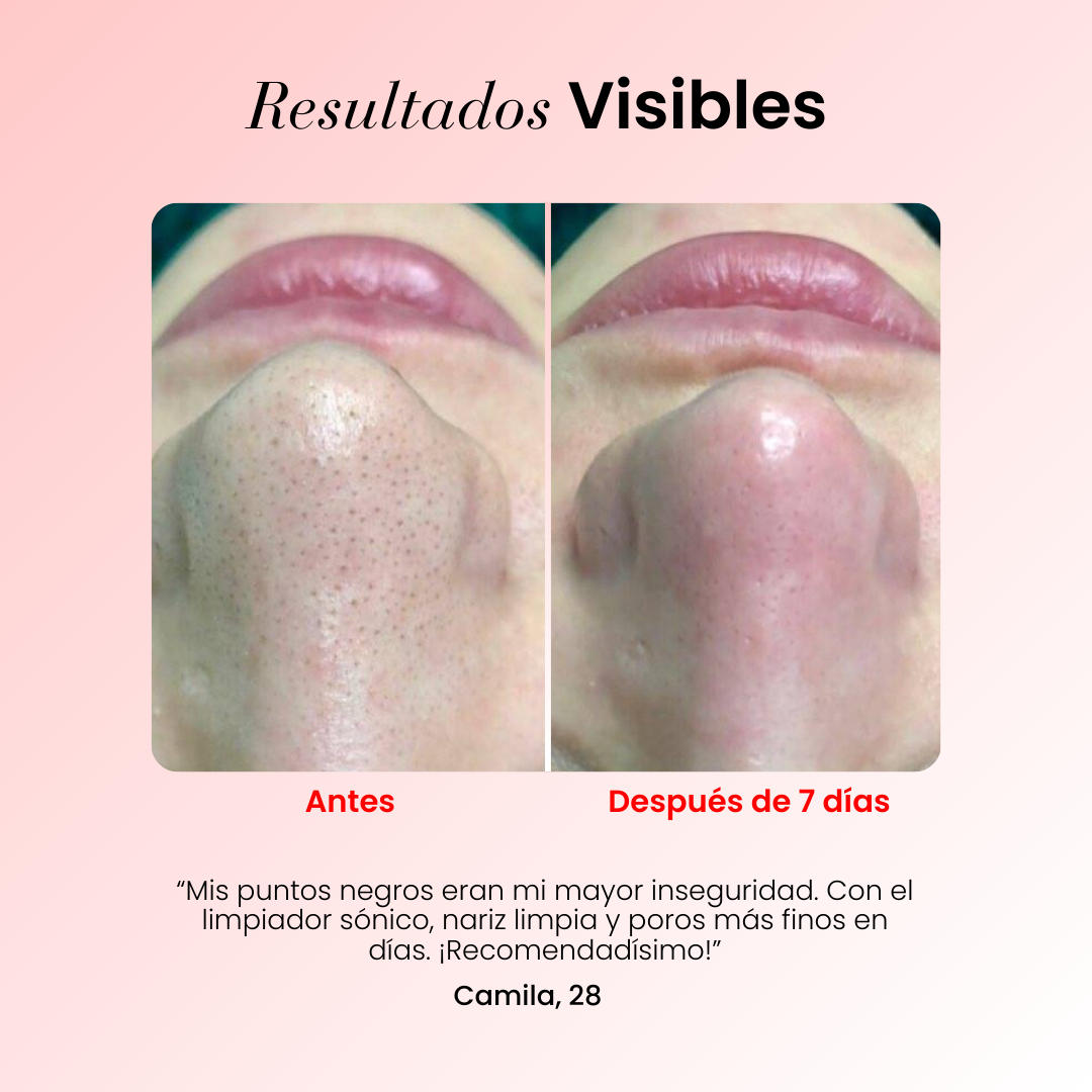 Limpiador Facial Sónico