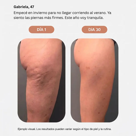 Emulsión Anticelulitis CELLULIX