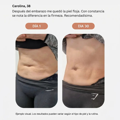 Emulsión Anticelulitis CELLULIX