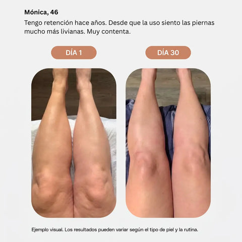 Emulsión Anticelulitis CELLULIX