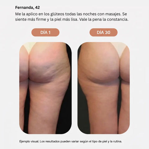Emulsión Anticelulitis CELLULIX
