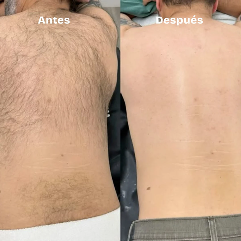 Borrador de Vello Glowara Black (For His & Her's)