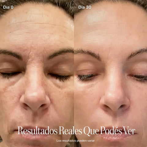 Varita 4-en-1 SkinFixgo!